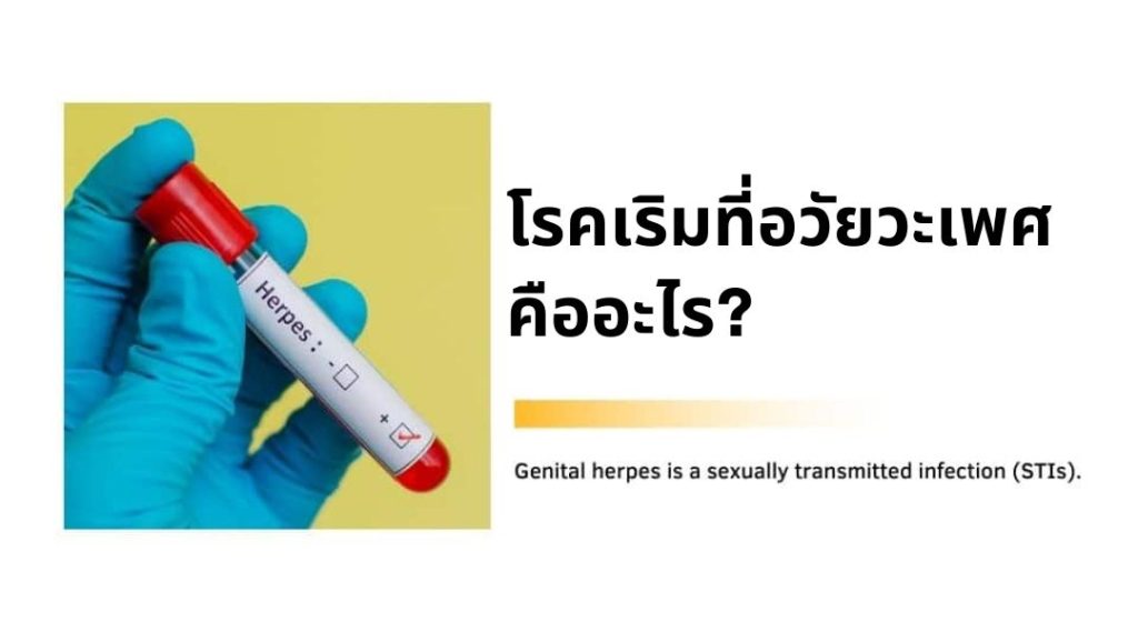 เริม ที่อวัยวะเพศ Genital Herpes