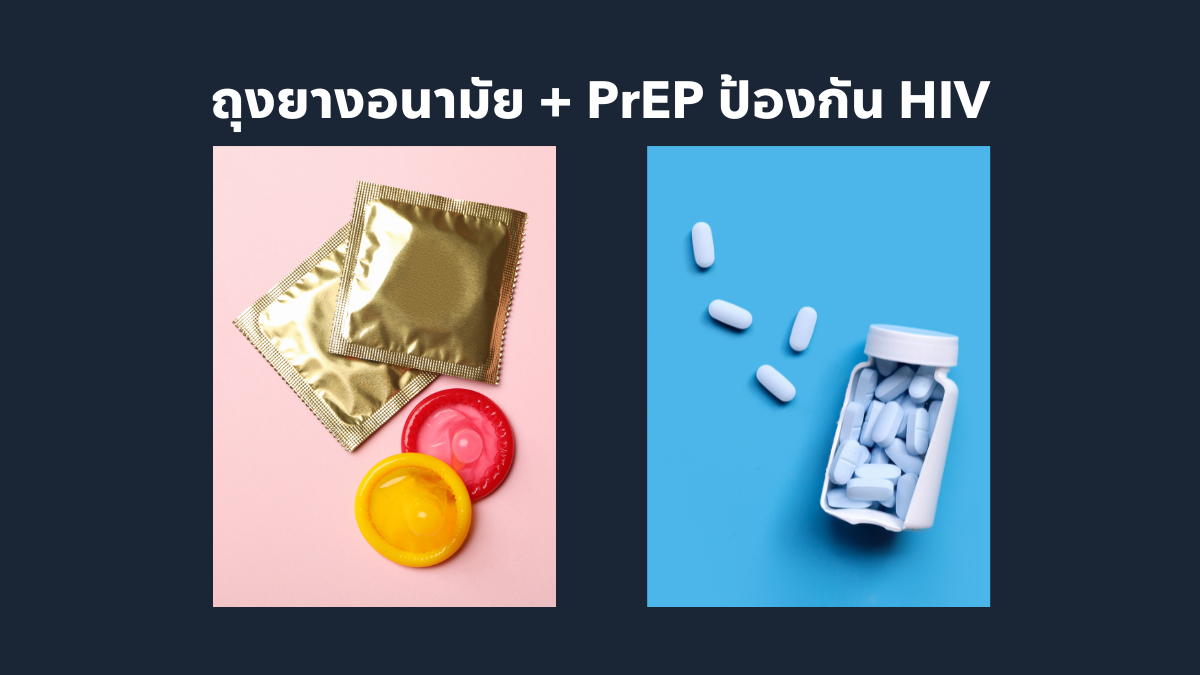 ถุงยางอนามัย + PrEP ป้องกัน HIV