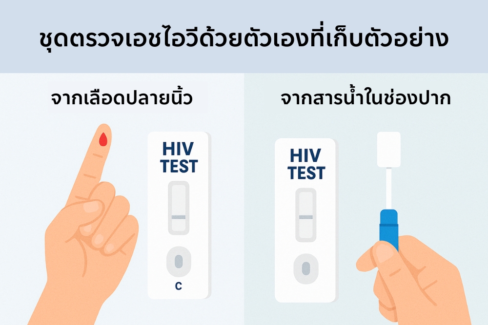 ชุดตรวจเอชไอวี ที่เก็บตัวอย่างจากเลือดปลายนิ้ว กับชุดตรวจเอชไอวีที่เก็บตัวอย่างจา