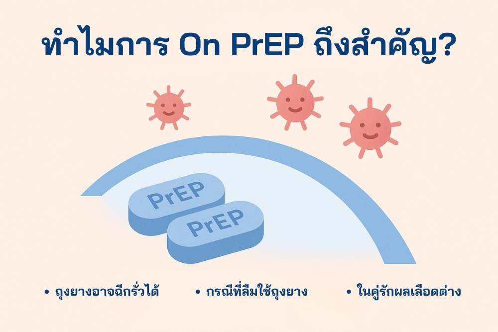ทำไมการ On PrEP ถึงสำคัญ